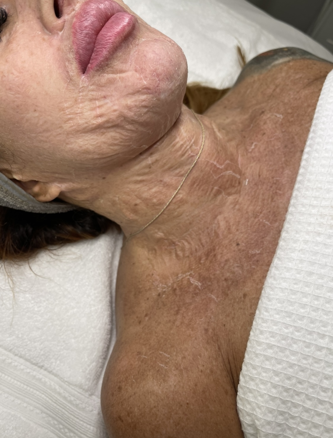 DMK Enzyme Facial at Plum Artistry & Esthetics, llc. in Peachtree Corners, GA