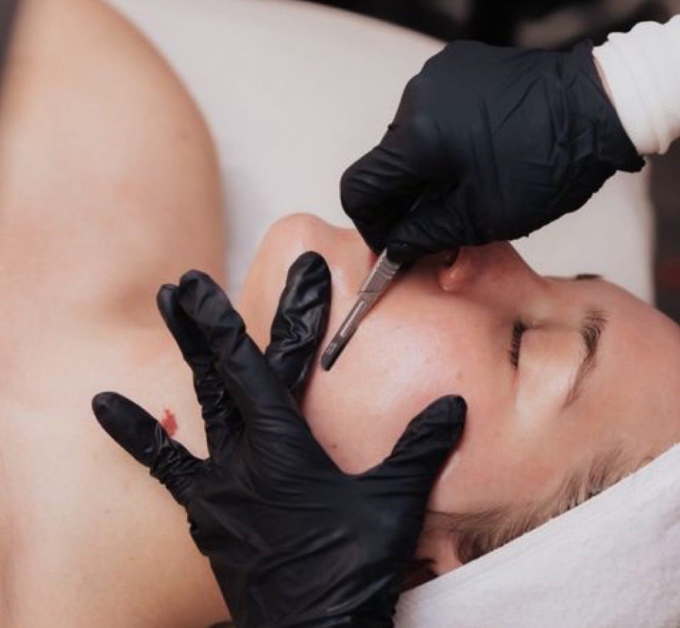 FACIAL ADD ON: Dermaplaining