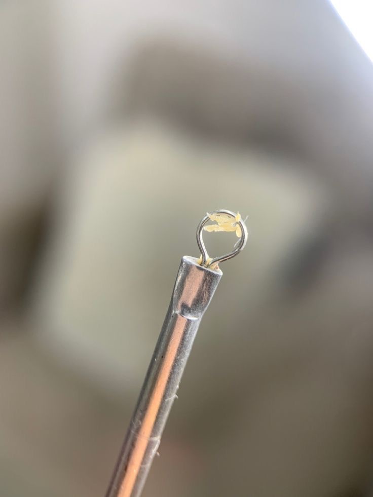 Extractions