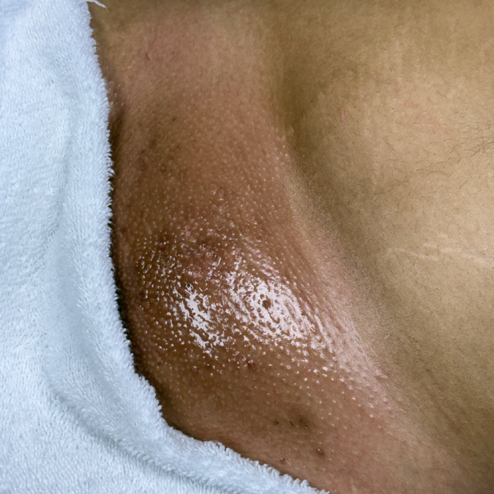 Vajacial + Brazilian at The Beauty Collective in Des Moines, IA