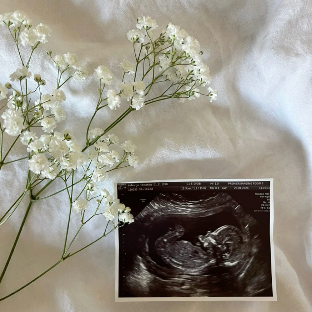 Pregnancy Safe Acne Facial at Aesthetics By Lexi in Clifton Park, NY