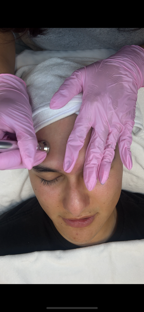 Facials - Microdermabrasion