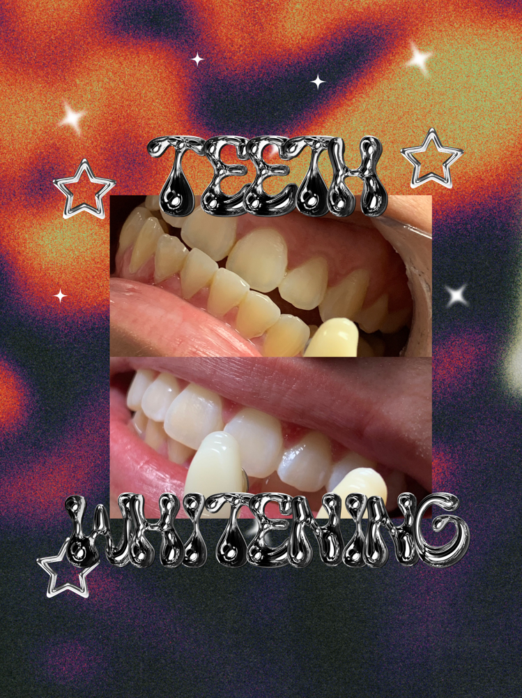 60 Min Teeth Whitening at Ethereal Beauty 444 LLC in Santa Ana, CA
