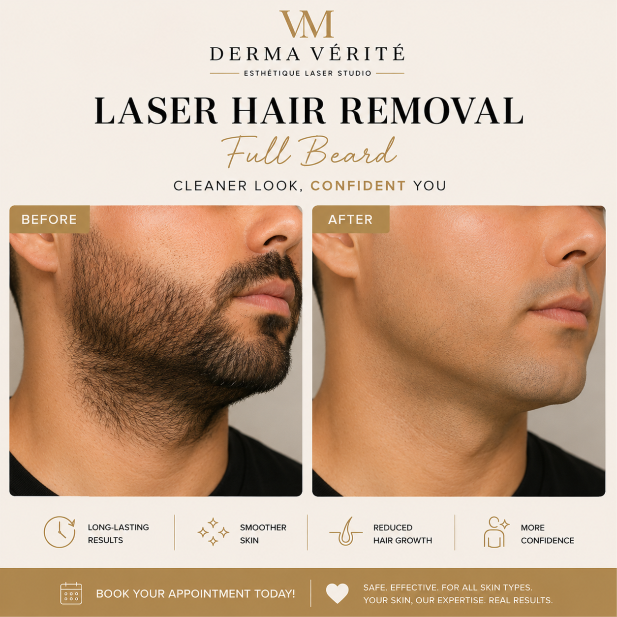 Full Beard Laser Hair Removal at Derma Verite Esthetique Laser Studio in Elmhurst, NY