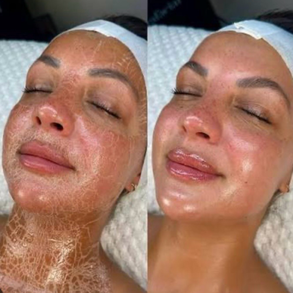 FIRMING PEPTIDE FACIAL at Kylee B. Esthetics in Columbia, LA