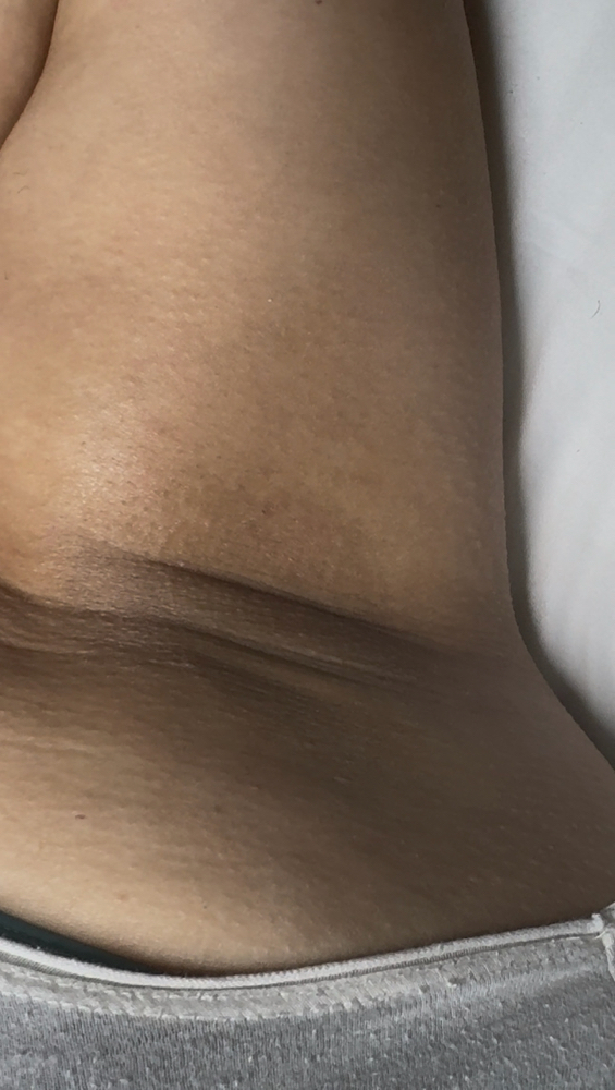 Underarm Wax