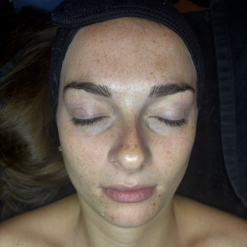 Clarifying Acne Facial at groovyglowwithmo in Shelbyville, IN