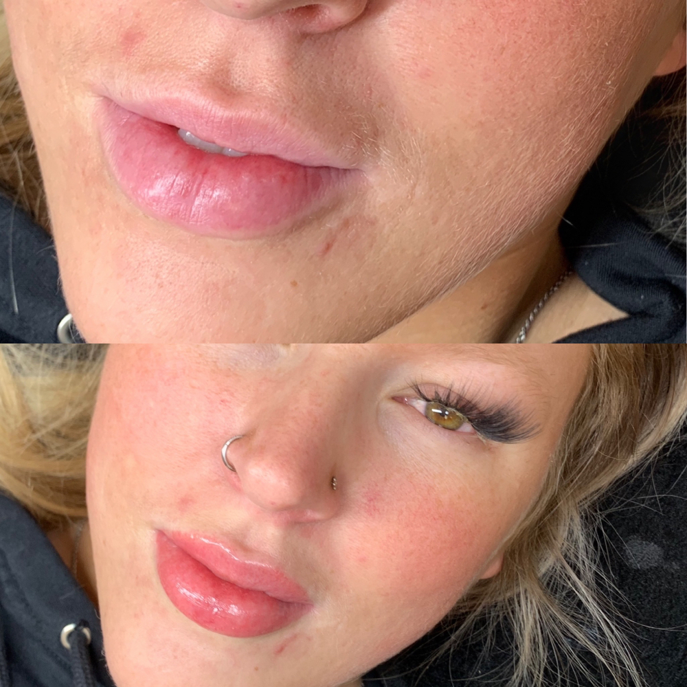 Lip Blushing