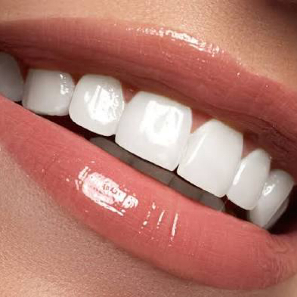 Express Glow at Enthused Smiles in Montclair, NJ