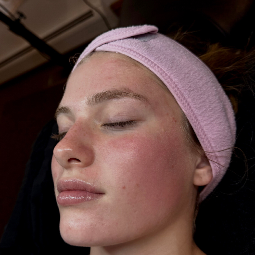Teen Facial at Jaime Rose Esthetics in Accord, NY