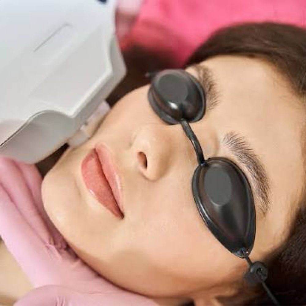 IPL Photofacial at Cedar & Sage Aesthetics & Wellness in Hiawassee, GA