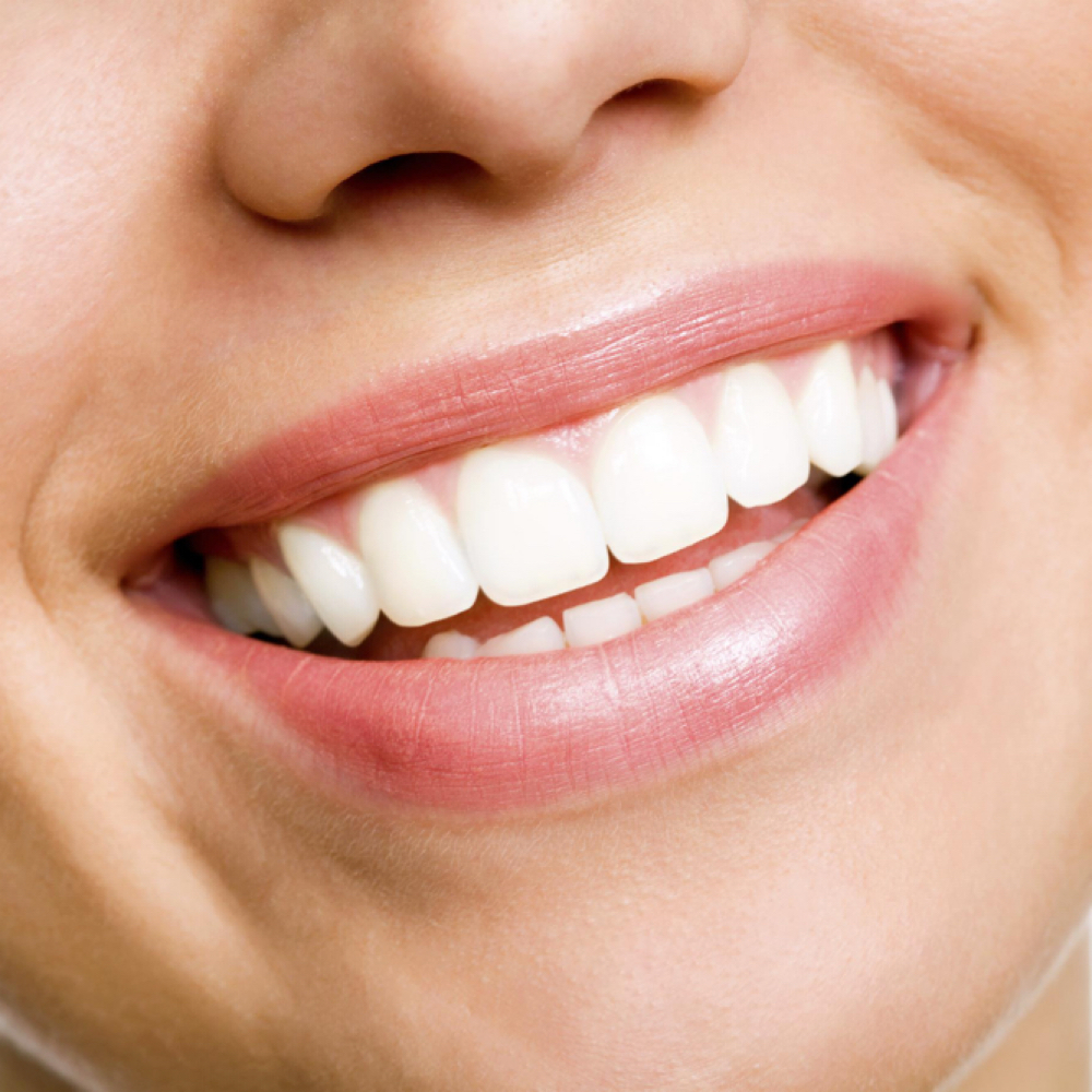 Express Teeth Whitening at Nueva Vida Medspa in Audubon, NJ
