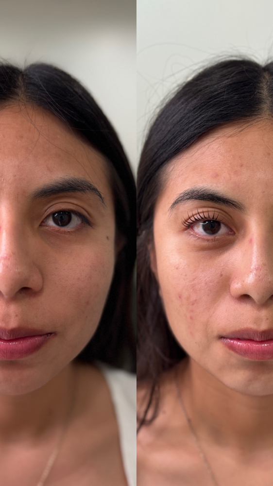 KOREAN LASH LIFT