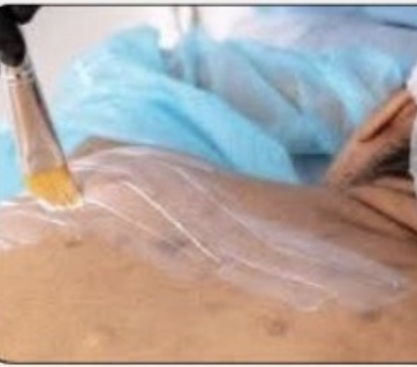 Back Facial With Extractions at Modern Techniques Salon & Boutique in Cicero, NY