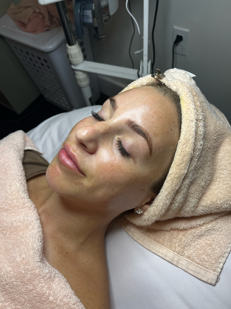 Rejuvenation Facial