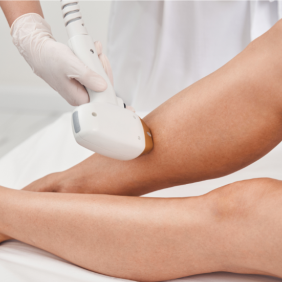 Laser Hair Removal 4 Areas XS to M at Epicentr in New York, NY