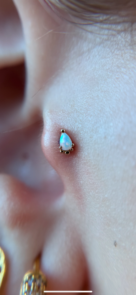 Tragus