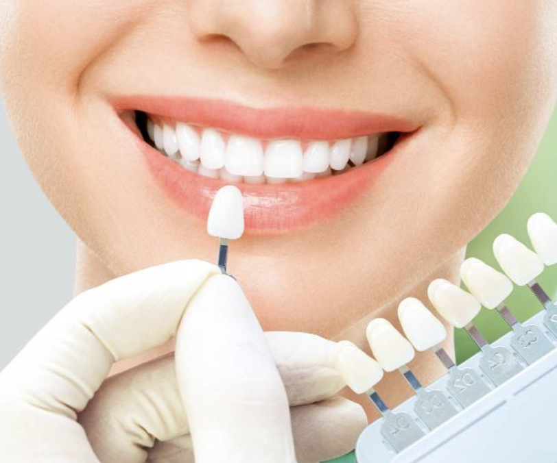 TEETH WHITENING RELAXING SESSION