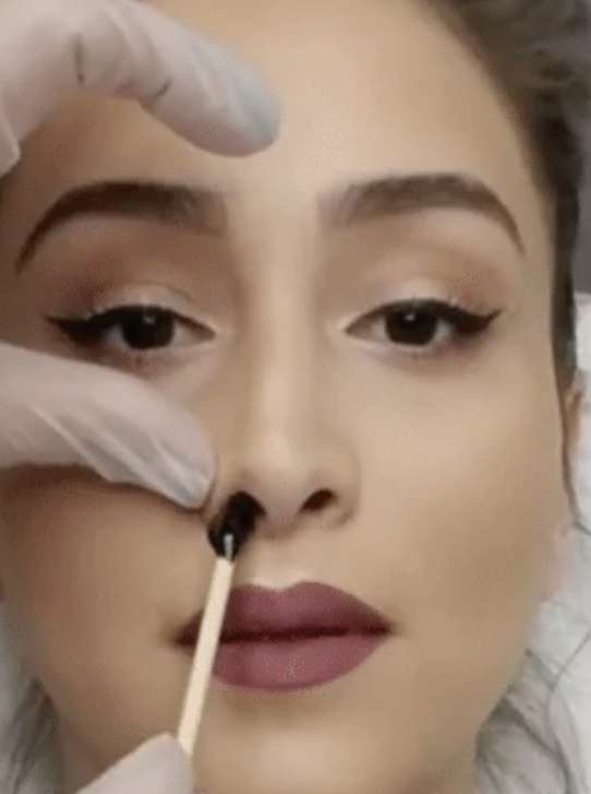 Nose