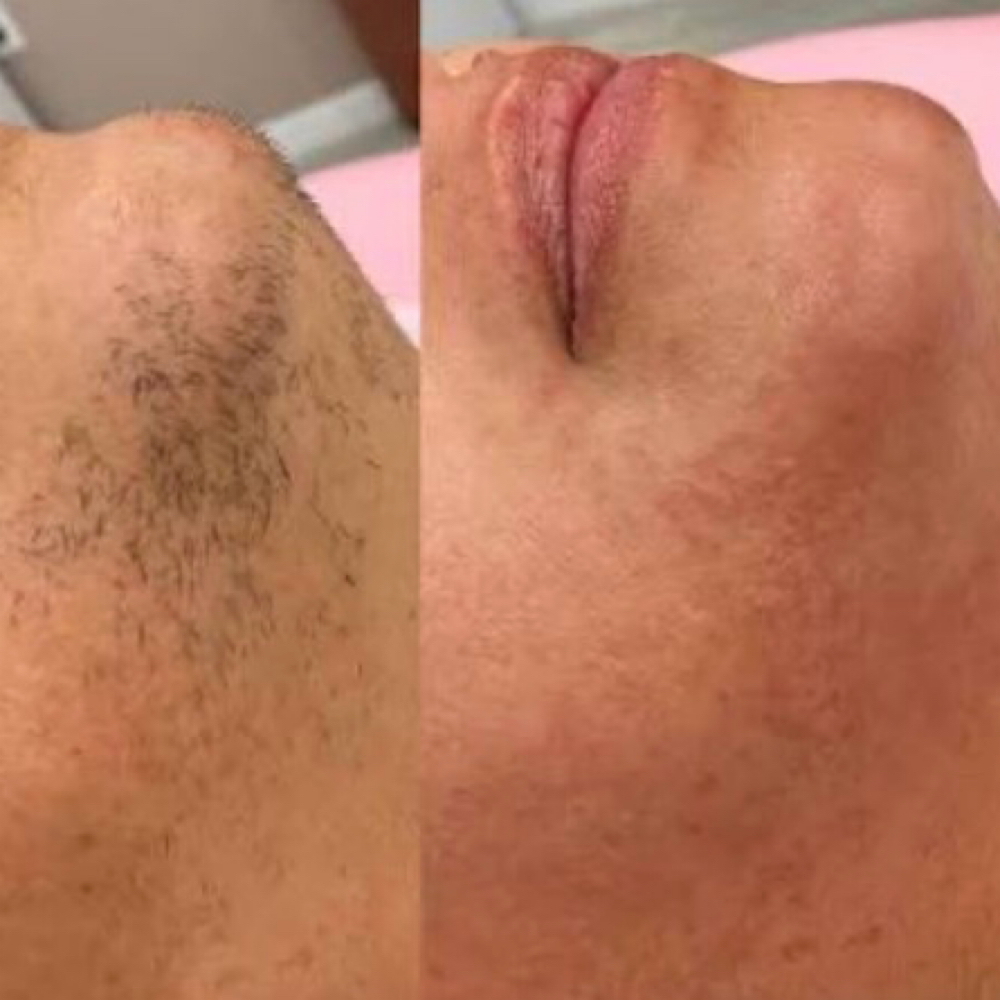 Chin wax at Casa De Esencia in Hendersonville, NC