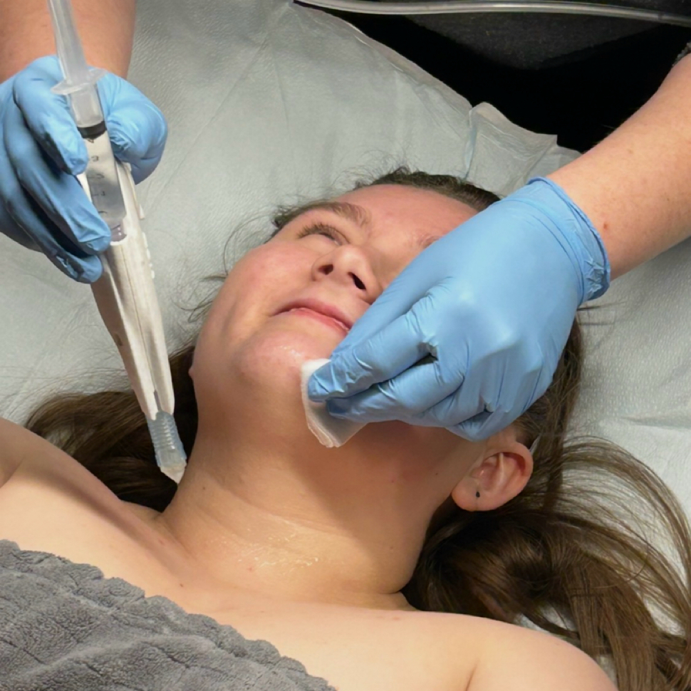 Breeze Facial at Angel Care Health and Wellness in Knoxville, TN