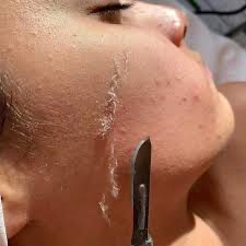 Dermaplaning with Mini Facial