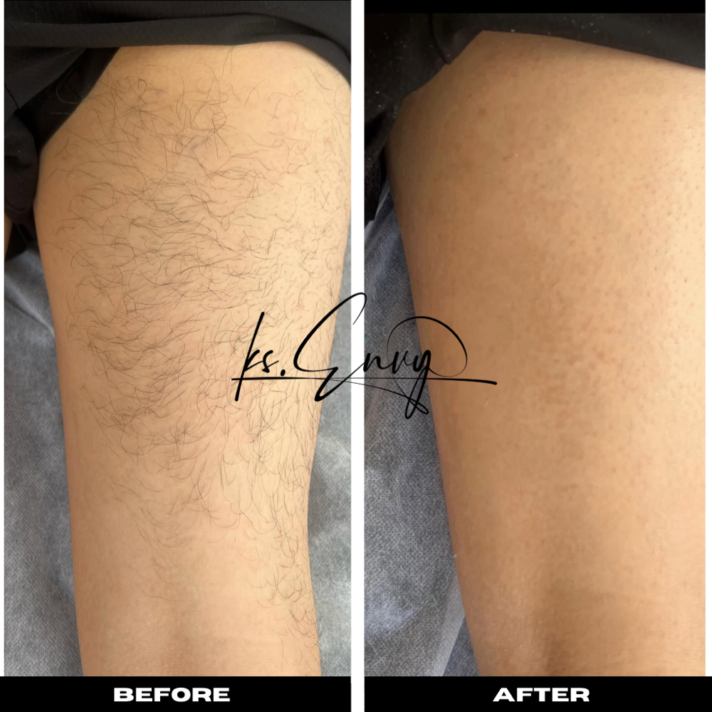 Thigh: Back at KS.Envy in Columbus, OH