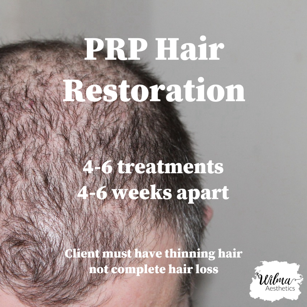 PRP Hair Restoration Bundle Of 4