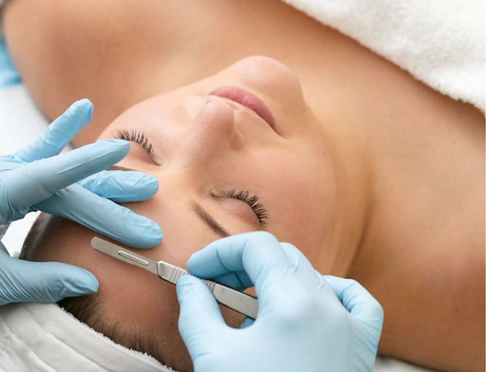 Dermaplaning