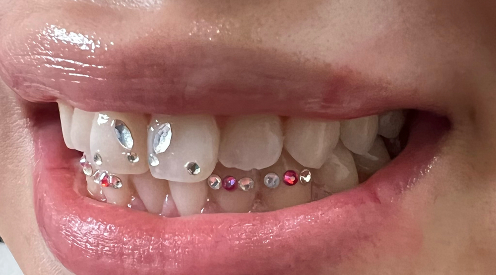 4 Tooth Gems or More