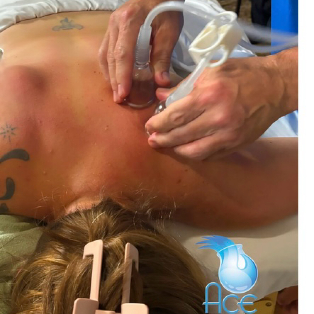 30 Minute Massage with Medicupping at Robin Moose/Custom Massage Therapy of Kannapolis in Kannapolis, NC