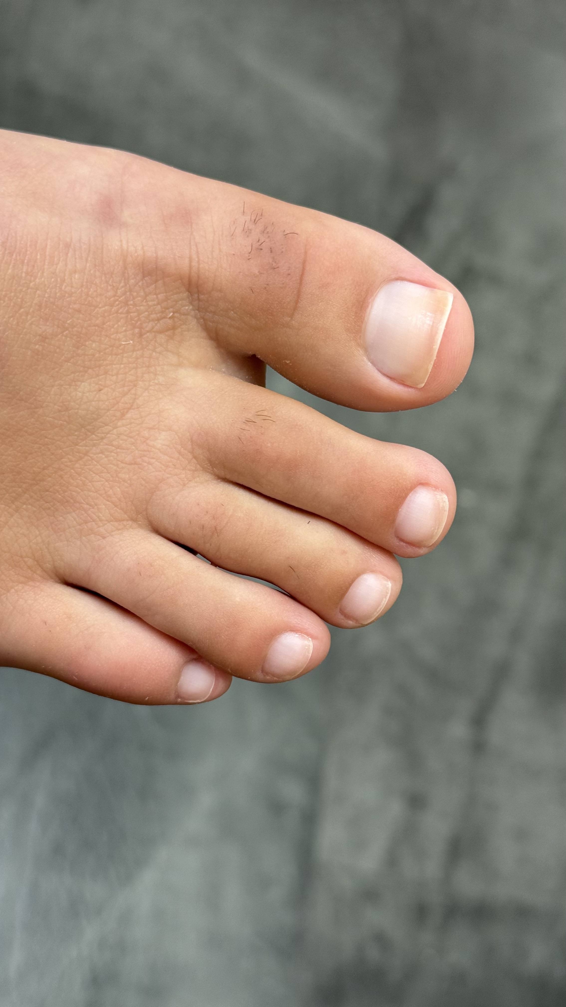 The Pedicure