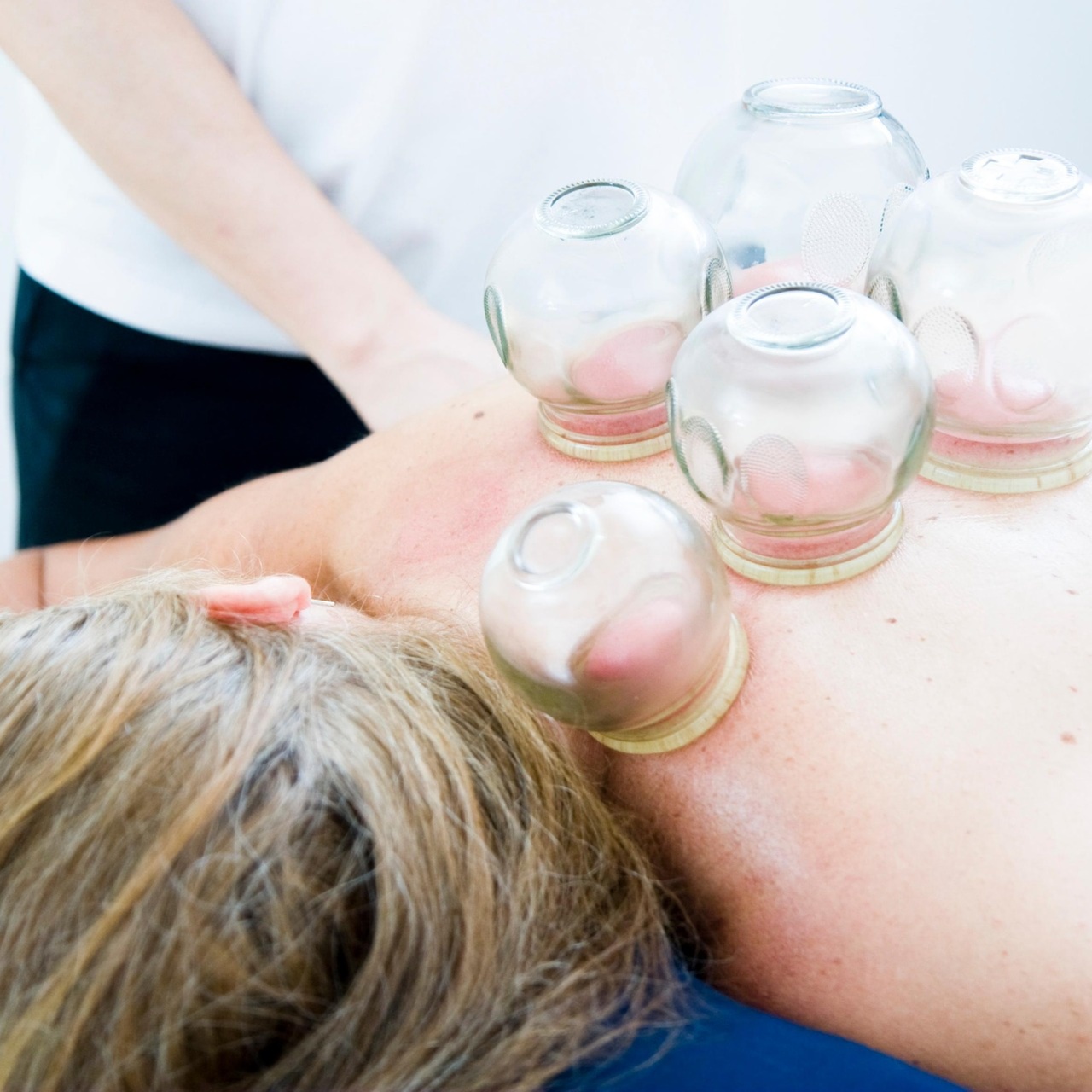 Chinese Therapeutic Cupping at Sara's Inner Peace Massage in Golden Valley, MN