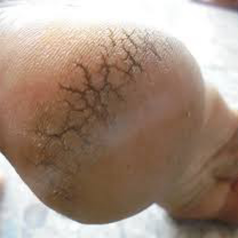 Heel Renewal added service medical) at The Nail Lab Nail Studios in Columbia, SC