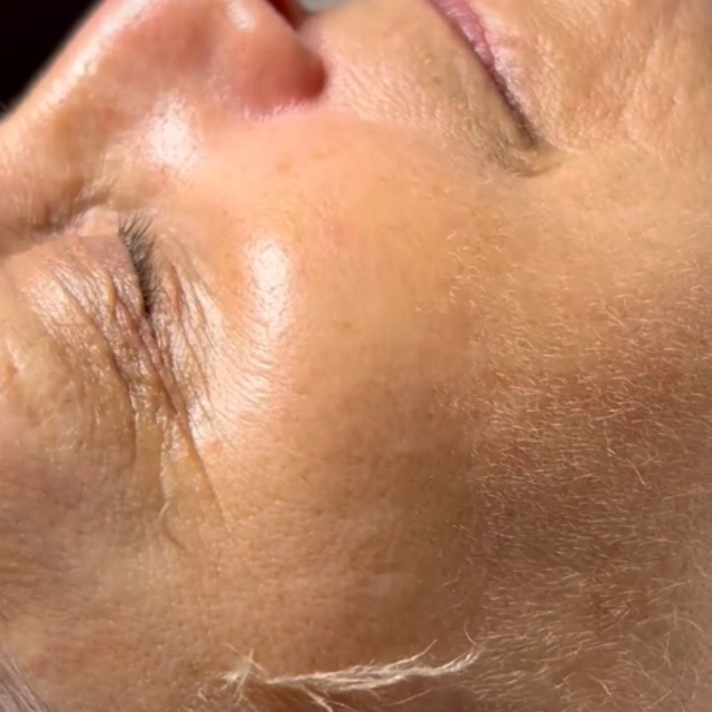 Dermaplane Add-On at Peyton Bustamante in Harrisburg, IL