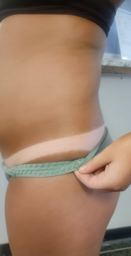 Sunless Spray Tan