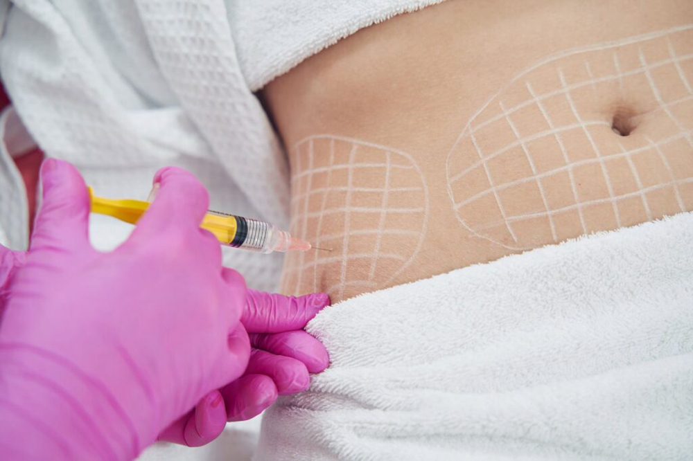 Liquid Lipo (PCDC) 1mg at Magneto Beauty Studio in Brownsville, TX