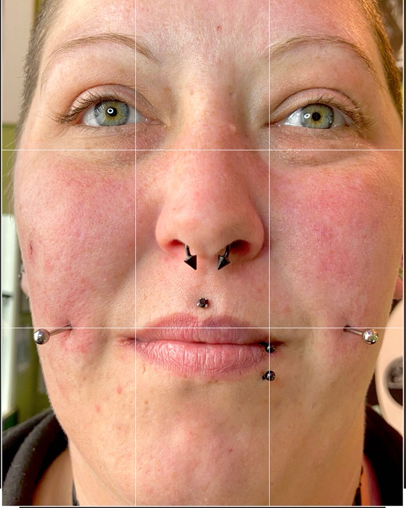 Paired Oral (lips, Cheeks, Mouth)