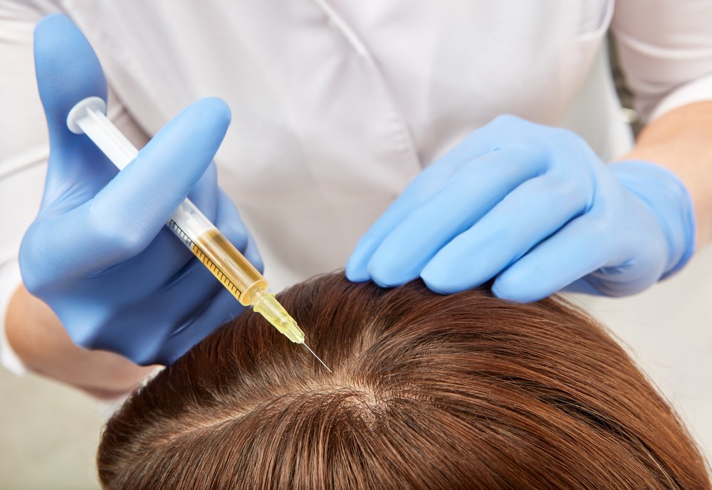 Hair Restoration with PRP
