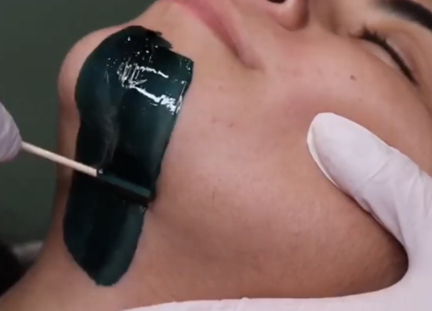 Chin Wax