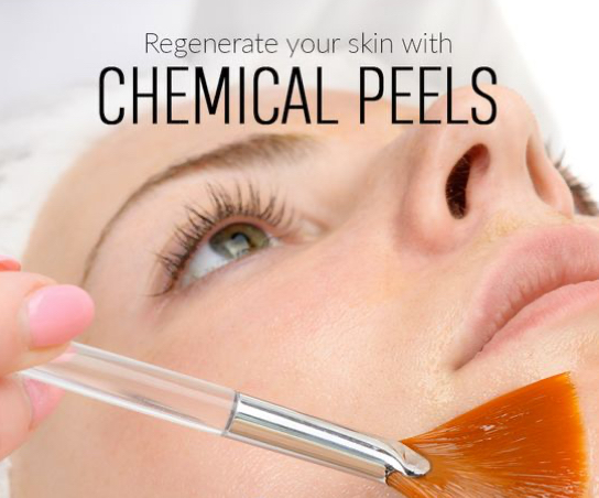 Chemical Peel