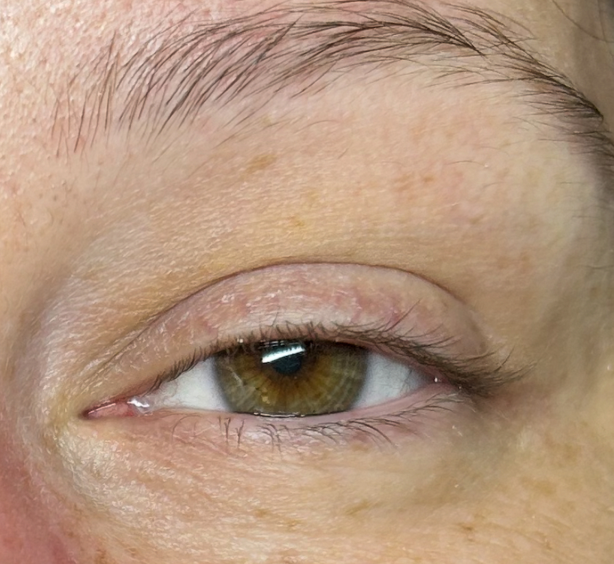 Lash Removal at Lash-N-Kee in Kokomo, IN