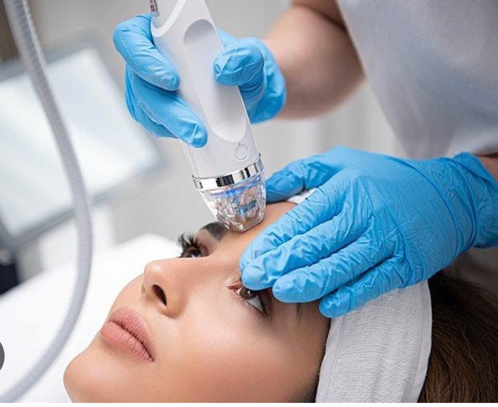 RF Microneedling Face at Luvlookbeautyspa @GlossGenius in Las Vegas, NV