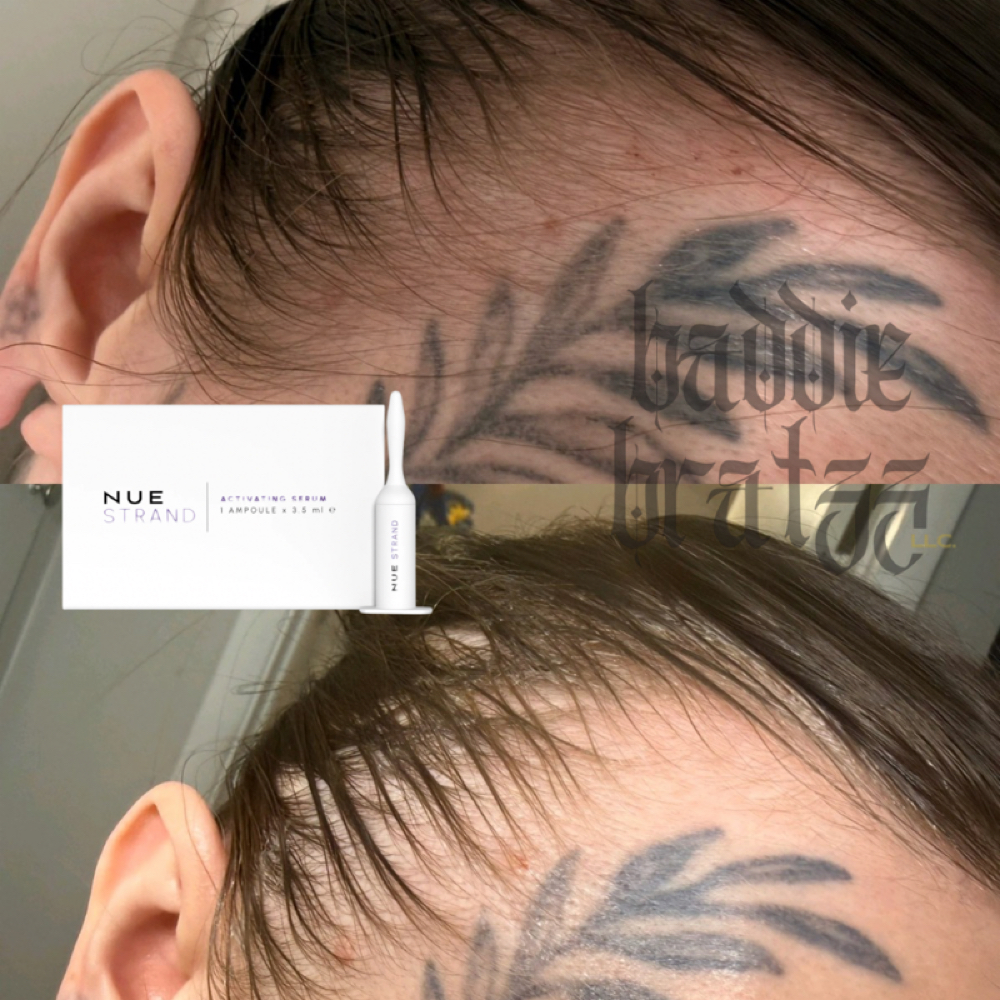 Hair Regrowth Service