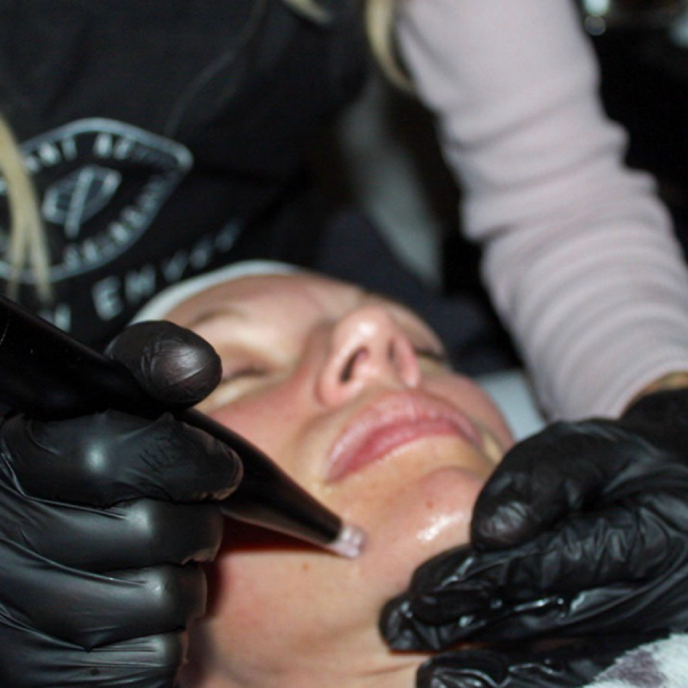 Nano Infusion Facial at Wild Sage Esthetics in Valdosta, GA
