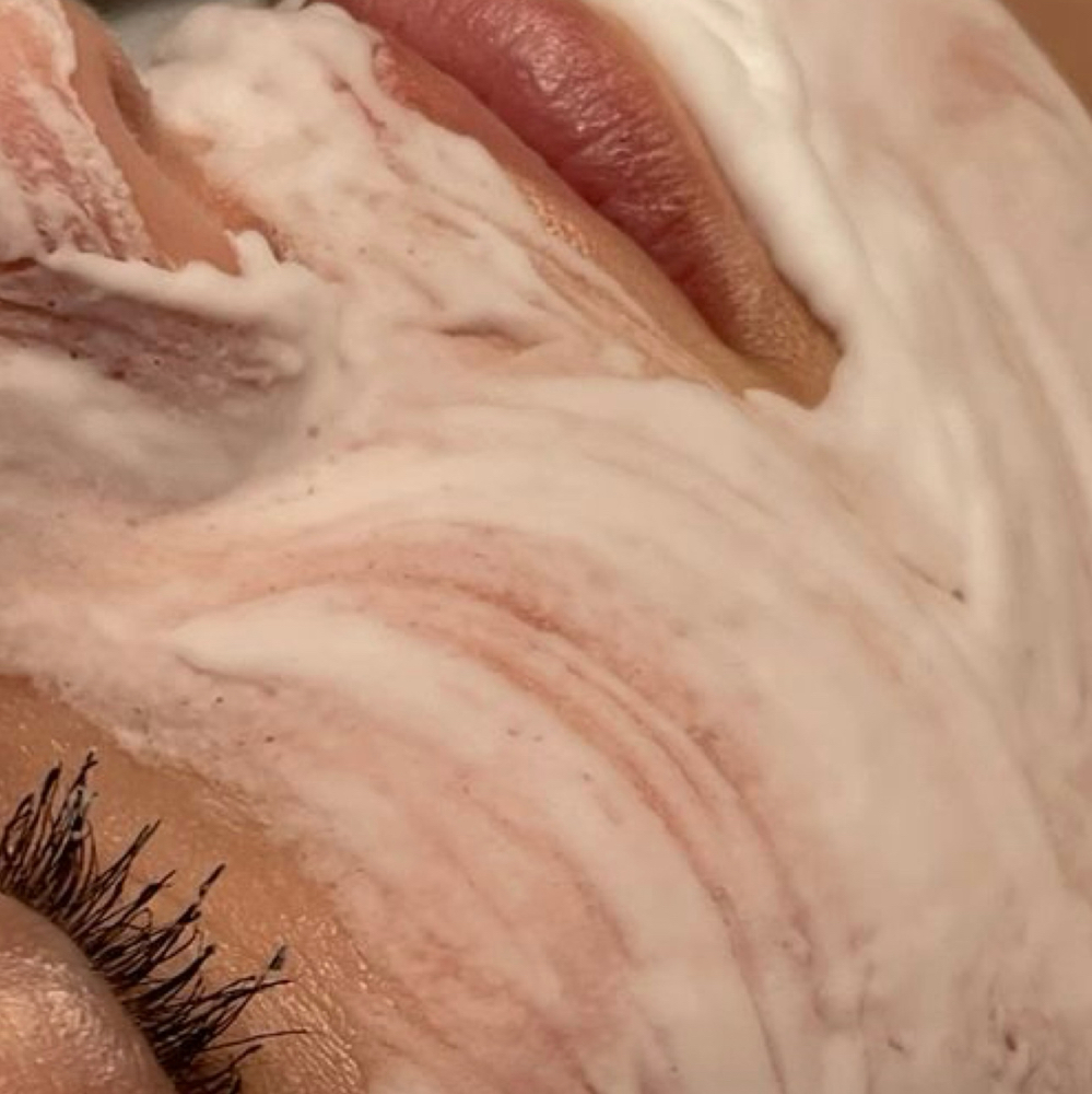 • OXYGEN FACIAL | O2 LIFT • at Tylar Aesthetics in Folsom, CA
