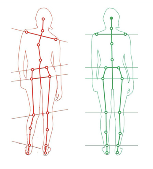 Posture/Walking Assesment