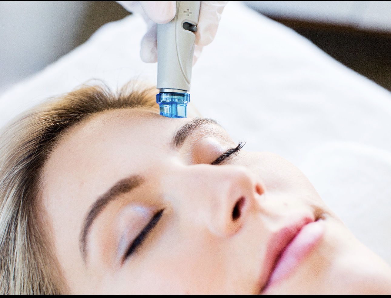 Hydrafacial at Aurora Glow Aesthetics in Spring, TX