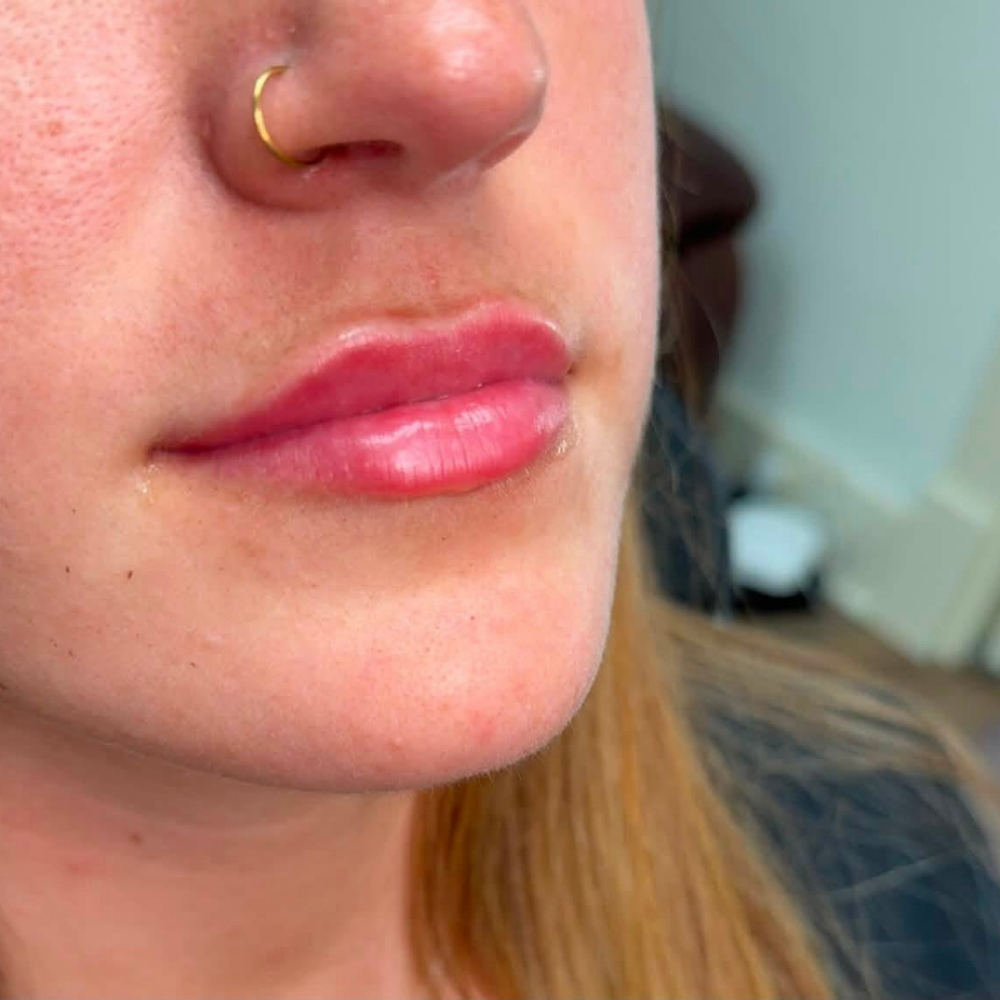 Mini Lip Plump at Sculpt & Glow by Madeline, LLC in McAlester, OK