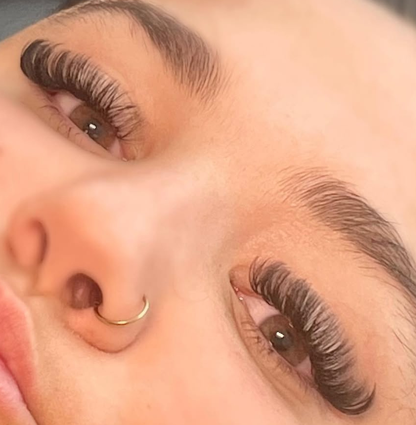 Volume fill In